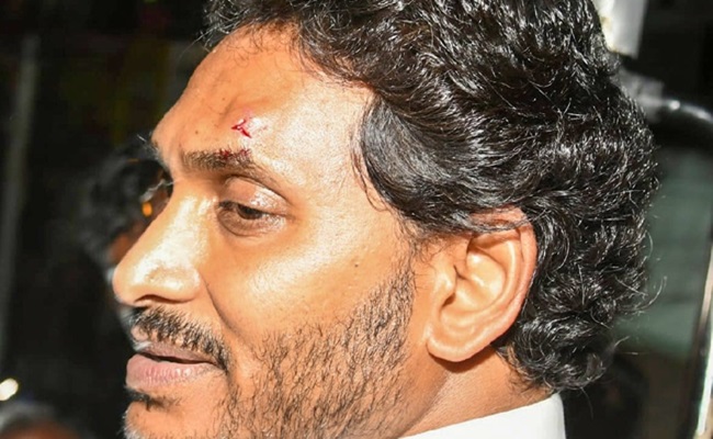 AP Police File Case Of Attempted Murder For Attack On CM Jagan